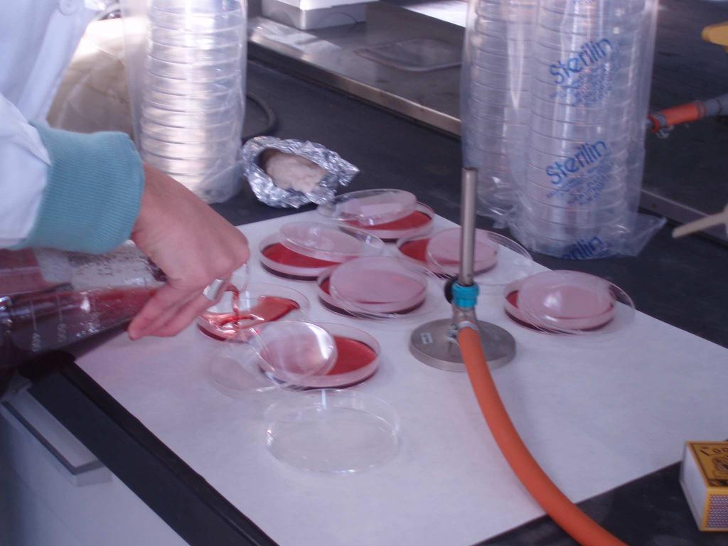 agarra; eskuinean, MacConkey agarra Petri kutxetan banatzen da esterilizatu ondoren.