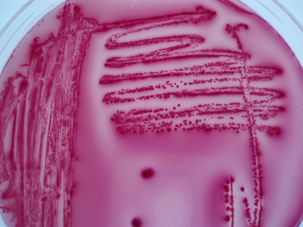 mikroorganismo anaerobioa batena; eskuinean, MacConkey agarrean hazi den bakterioa.