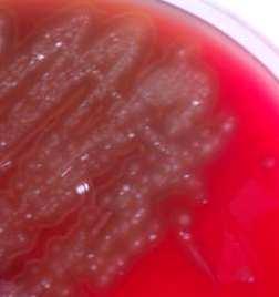 Estreptokoko patogenoek kanporatutako hemolisinek agarrean dauden eritrozito guztiak suntsitzen dituzte (beta hemolisia) edo, gutxienez, kalte