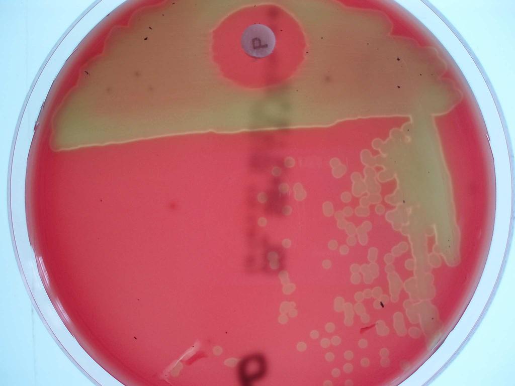 Streptococcus viridans (ahoko mikrobioak). 3.B. Staphylococcus aureus espezie patogenoa bereizi.