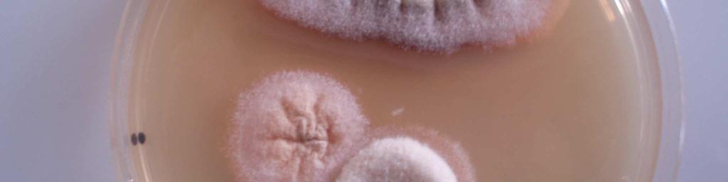 Kolonien itxura makroskopikoak Sabouraud agarrean legamiak eta lizunak