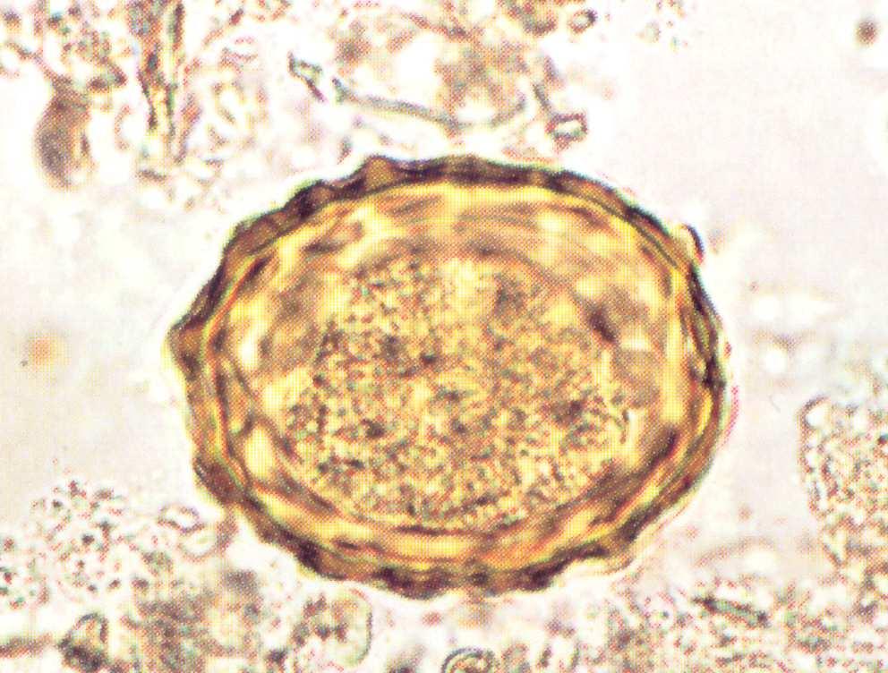 Mikroskopioetan helminto patogenoen forma diagnostikoak bereiztea: o Digestio-aparatuko helmintoen kasuan
