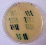 Serven para identificar bacterias que conteñen o vector de clonación, porque estas bacterias serán resistentes ó antibiótico do xen marcador. - Xenes de luminiscencia.
