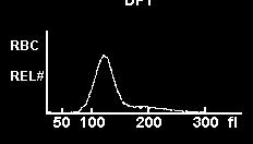 Red cell Distribution Width - RDW MCV Μικροκυτταρική