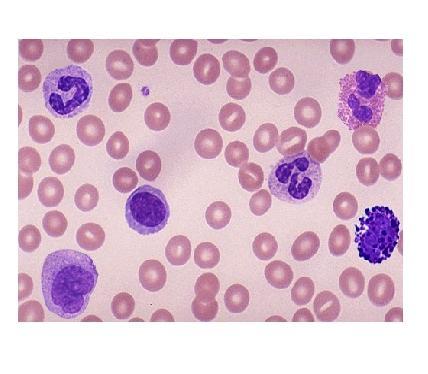 Λευκοκυτταρικός τύπος Ουδετερόφιλα (Neutrophils) συχνά αναφέρονται με διάφορα ονόματα στα αιμοδιαγράμματα : polys