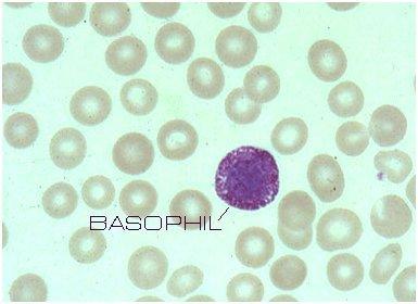 Λευκοκυτταρικός τύπος Ηωσινόφιλα Αίτια βασεοφιλίας Αίτια βασεοπενίας Ιοεγενείς λοιμώξεις, μυξοίδημα, ελκώδης κολίτιδα, μετά σπληνεκτομή Νόσος