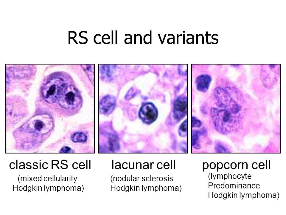 RS κύτταρα και