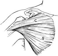 Μείζων θωρακικός μυς 3 Μεγαλύτερη συμμετοχή της μιας ή της άλλης μοίρας: Στην κίνηση του βραχίονα από πίσω και πλάγια προς τα εμπρός (δισκοβολία) μετέχει κυρίως η εγκάρσια στερνοπλευρική μοίρα.