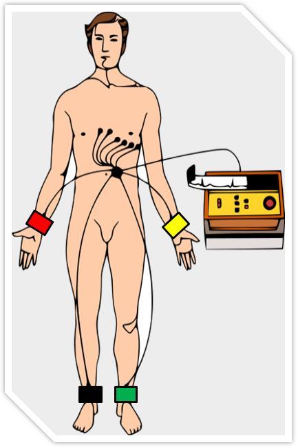 Α. ΠΑΡΑΚΟΛΟΥΘΗΣΗ ΚΑΡΔΙΑΚΟΥ ΡΥΘΜΟΥ Το ηλεκτροκαρδιογράφημα γίνεται με ειδικό μηχάνημα τον ηλεκτροκαρδιογράφο (ΗΚΓφο) που είναι