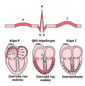 Α. ΠΑΡΑΚΟΛΟΥΘΗΣΗ ΚΑΡΔΙΑΚΟΥ ΡΥΘΜΟΥ Το φυσιολογικό ηλεκτροκαρδιογράφημα αποτελείται από ένα έπαρμα (κύμα) Ρ, ένα «σύμπλεγμα» QRS