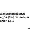 λατομείου, ή εκσκαφών βράχου από τα αντερείσματα της κοιλάδας, ενώ ο αδιαπέρατος πυρήνας