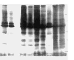 2 211 SD S2PA GE (F ig 1A ), PND 3 PND 7 PND 21, 8 11 11 7 T ab le 1, 32 P T ab le 1 F ig 1 Gradient SD S2PA GE auto radiograph analysis on, PND 21, 32 p ro tein pho spho rylation in rat cerebral co