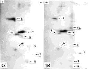 F ig 2 P ro tein pho spho rylation auto radiograph in rat cerebral co rtex synap to som es of PND 21 (a) and adult (b) analyzed by 22D 2PA GE A rrow heads show pho sphop ro teins in (a) and (b) T he