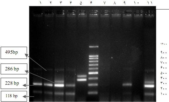 9 64 Downloaded from jarums.arums.ac.ir at 9: IRST on Sunday January th 9 erm multiplex PCR. 8 7. 6 ) Gene erma ermb ermc ermtr (. 9 5 4. cmls B [7] erm.