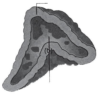 gfâ - M II. m. FW»a édh fÿ : 20 x 2 = 40 M. VnjD«ÏUgJ édh fs F éilaë fî«. 16. nehœfisí«mj fhuâfisí«bghu Jf. nehœ nehœ fhuâ 1. Ï òqa [h - ik nuh nghu«2. rhjhuz rë - ik nfh gh Oça«3.