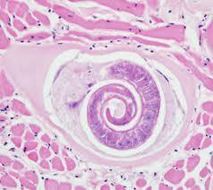4 Εικόνα 7. Προνύμφη Trichinellas spiralis σε μυϊκό ιστό.