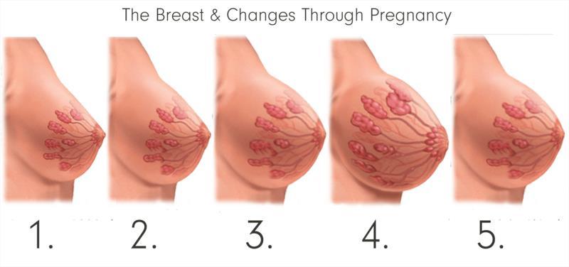 Προετοιμασία του Μαστού στην Εγκυμοσύνη Η προετοιμασία των μαστών για το θηλασμό ξεκινάει με την έναρξη της κύησης (Loedermilk, 2016).