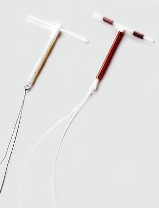 89 patients mean age at insertion was 19.5 years (range 16-22 years) Copper 13%; levonorgestrel 87% of patients The mean duration of use was 331.