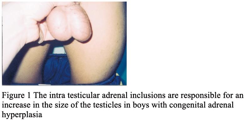 TARTS: Testicular
