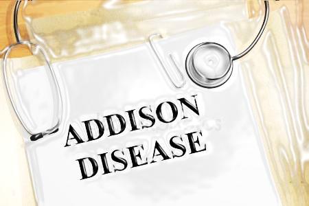 Η νόσος του Addison (χρόνια επινεφριδιακή ανεπάρκεια) είναι η νόσος των επινεφριδίων που χαρακτηρίζεται από την ανεπαρκή η παντελή έλλειψη έκκρισης κορτιζόλης από τα επινεφρίδια Χαρακτηρίζεται από: