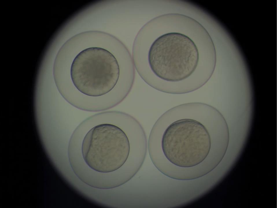 Zebrafish Embryonic development