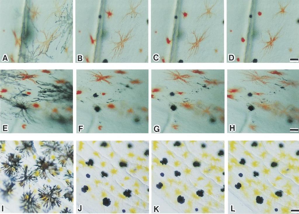 Χρωματοφόρα (chromatophores) Φυσιολογική vs.