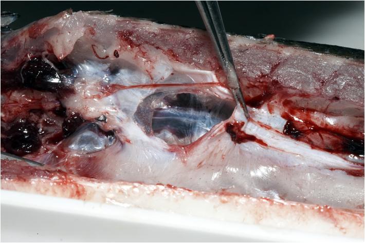 Kidneys, interrenal