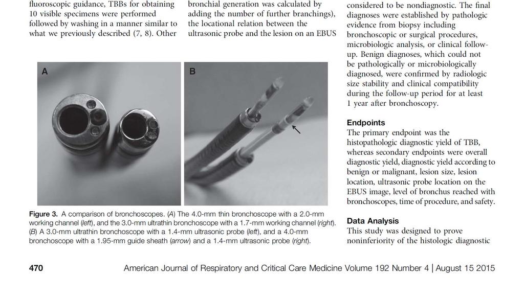 Ultrathin bronchoscope Ultrathin