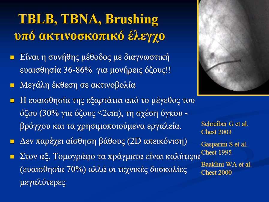 Aκτινοσκοπική καθοδήγηση υπό CT Dr David Feller-Kopman