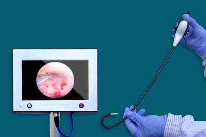 Single use bronchoscopes
