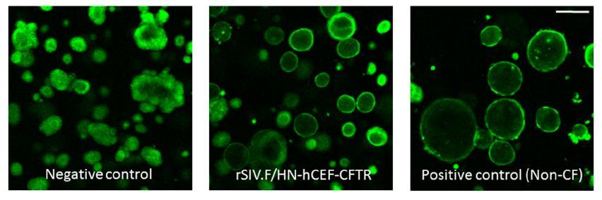 Preparation for a first-in-man lentivirus trial in patients with cystic fibrosis Alton EWFW, et al.