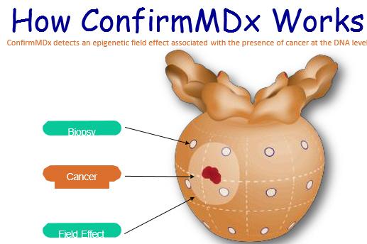 Βιοδείκτες -Confirm MDx Epigenetic assay - δείγμα ιστού Άλως του όγκου Εχει ένδειξη σε προηγηθείσα βιοψία Ποσοτικοποιεί την μεθυλίωση του DNA