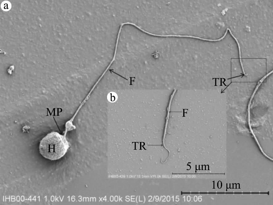 2016 35 4 Sichuan Journal of Zoology Vol. 35 No. 4 2016 1 Fig. 1 Ultrastructure of Hucho bleekeri Kimura spermatozoa H. MP. F. TR. H. head MP. mid-piece F. flagellum TR. transition region. 2 a b Fig.