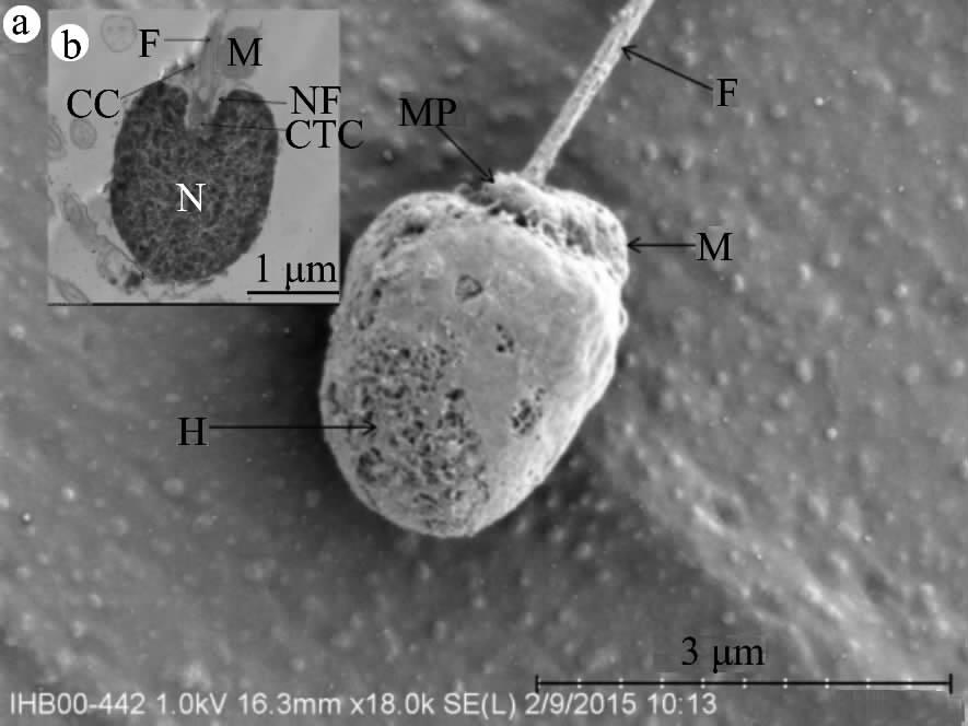 nucleus CTC. centriolar complex CC. cytoplasmic canal NF. nuclear fossa. 2 b 2 a 0. 56 μm ± 0. 10 μm n = 16 0. 81 μm ± 0. 19 μm n = 17 1 58. 18 nm ± 15. 80 nm n = 13 1 1 0. 82 μm ± 0.
