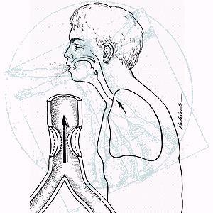 Asthma COPD Overlap (ACO) = Περισσότερες