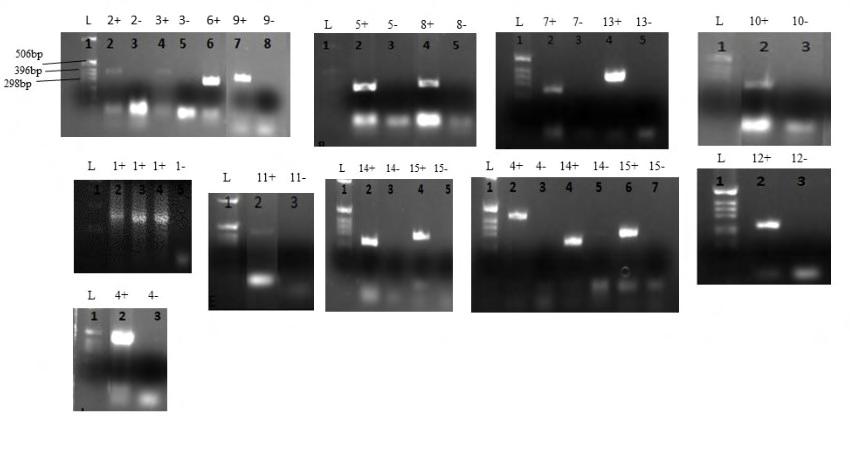 3. Αποτελέσματα Α) Ενίσχυση με PCR των εξονίων του γονιδίου PTPN11 Η μελέτη αφορά μία 63χρονη ασθενή, που τα κλινικά της χαρακτηριστικά, δηλαδή η παρουσία πολλαπλών εφηλίδων, η ύπαρξη αρτηριακής