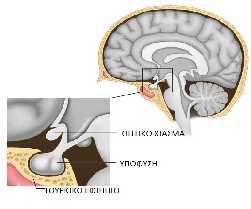 Εικόνα 1.3 Η θέση της υπόφυσης Η υπόφυση διακρίνεται σε 2 τμήματα, τα οποία διαφέρουν στην καταγωγή, τη δομή και τη λειτουργία τούς: την αδενοϋπόφυση και τη νευροϋπόφυση. (12) 2.3. ΘΥΡΕΟΕΙΔΗΣ ΑΔΕΝΑΣ Εικόνα 1.