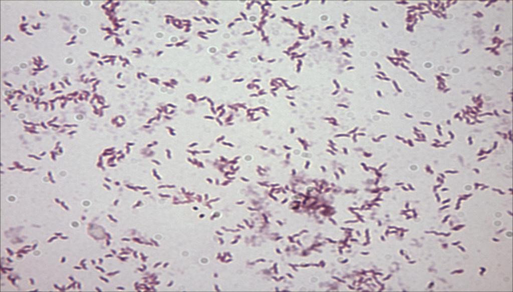 Cambylobacter με Gram