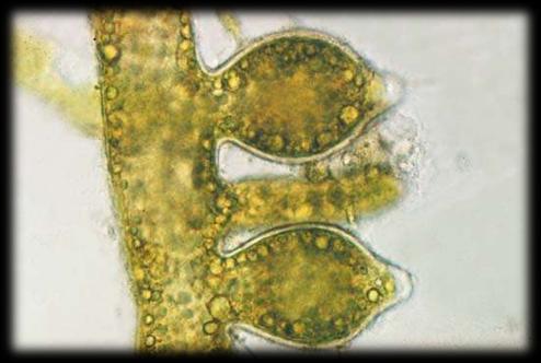 flagellum).