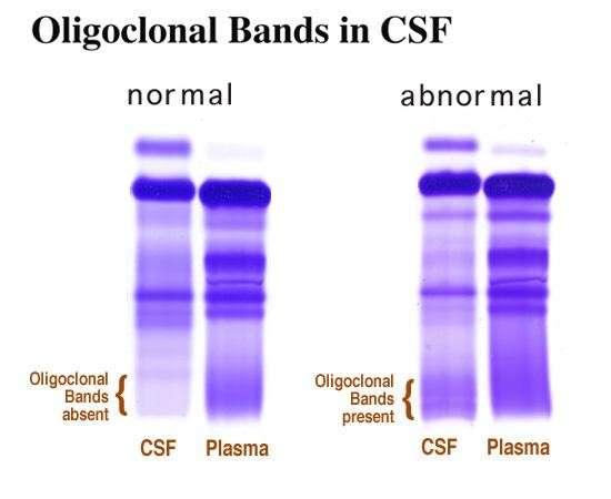 3: Identical OCBs