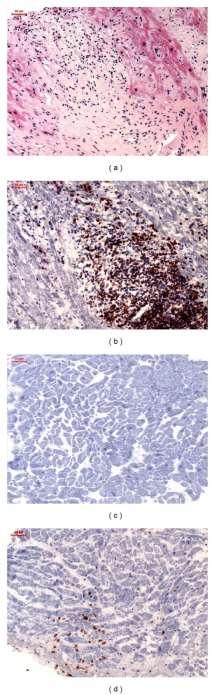 New Echo Findings Correlate with