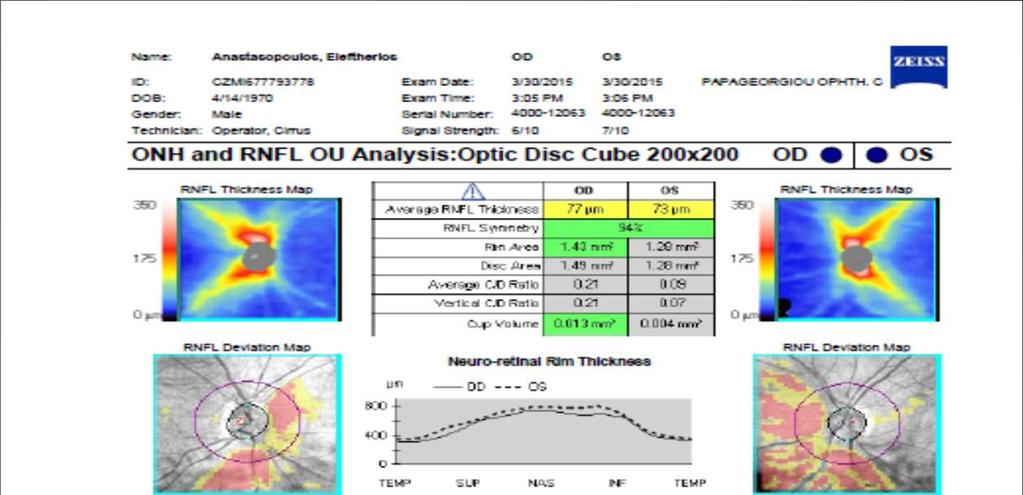 Myopia False positive