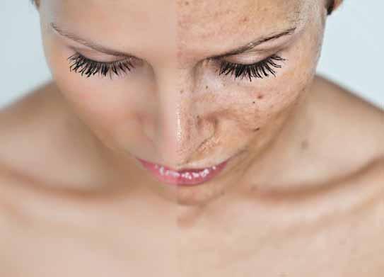 tetraciklini, tretinoin), upalni procesi na koži, akne, opekline, brijanje, endokrine i druge bolesti.