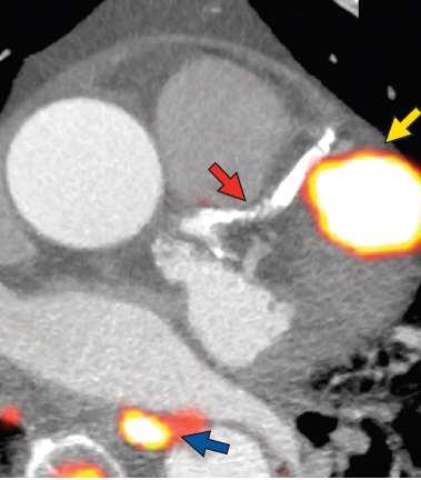 PET/CT Joshi