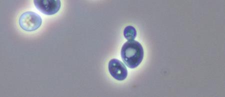 του αιμοκυτταρομέτρου. Στοχεύστε να υπάρχουν 80-200 κύτταρα στα 5 τετραγωνίδια μέτρησης. 3. Στο αραιωμένο δείγμα προσθέστε μερικές σταγόνες μπλε του μεθυλενίου (1:1). 4.