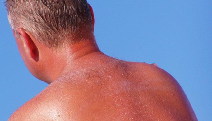 Θερμορύθμιση Το δέρμα έχει διττή θερμορυθμιστική λειτουργία: Φέρει ειδικούς υποδοχείς