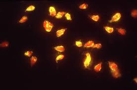 κυτταροκαλλιέργειες εναιωρήματα ζωντανών κυττάρων επιχρίσματα κυττάρων ή μικροοργανισμών