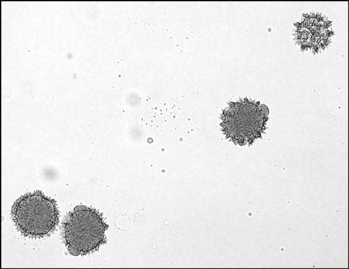 Εικ. 29: Γυρεόκοκκοι του Hymenonema graecum, ομάδα 1 (καλλιεργημένο υλικό από την Κύθνο).