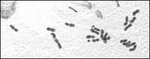 Hymenonema
