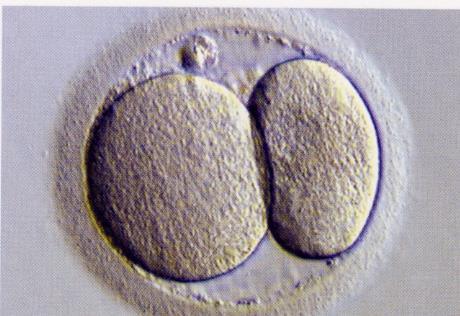 2η ΜΕΡΑ-2